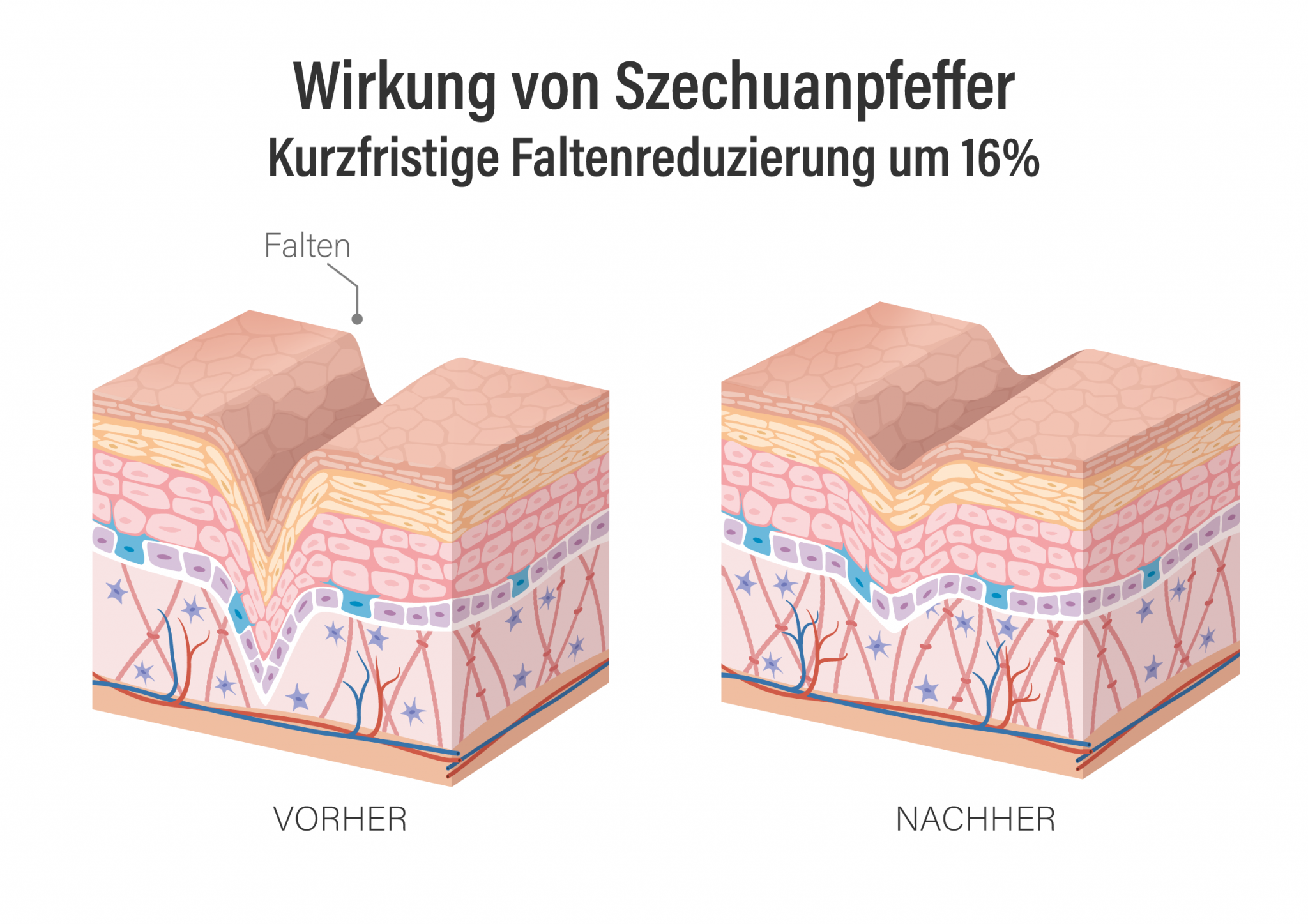 Studien konnten nachweisen, dass Szechuanpfeffer wie Botox wirkt