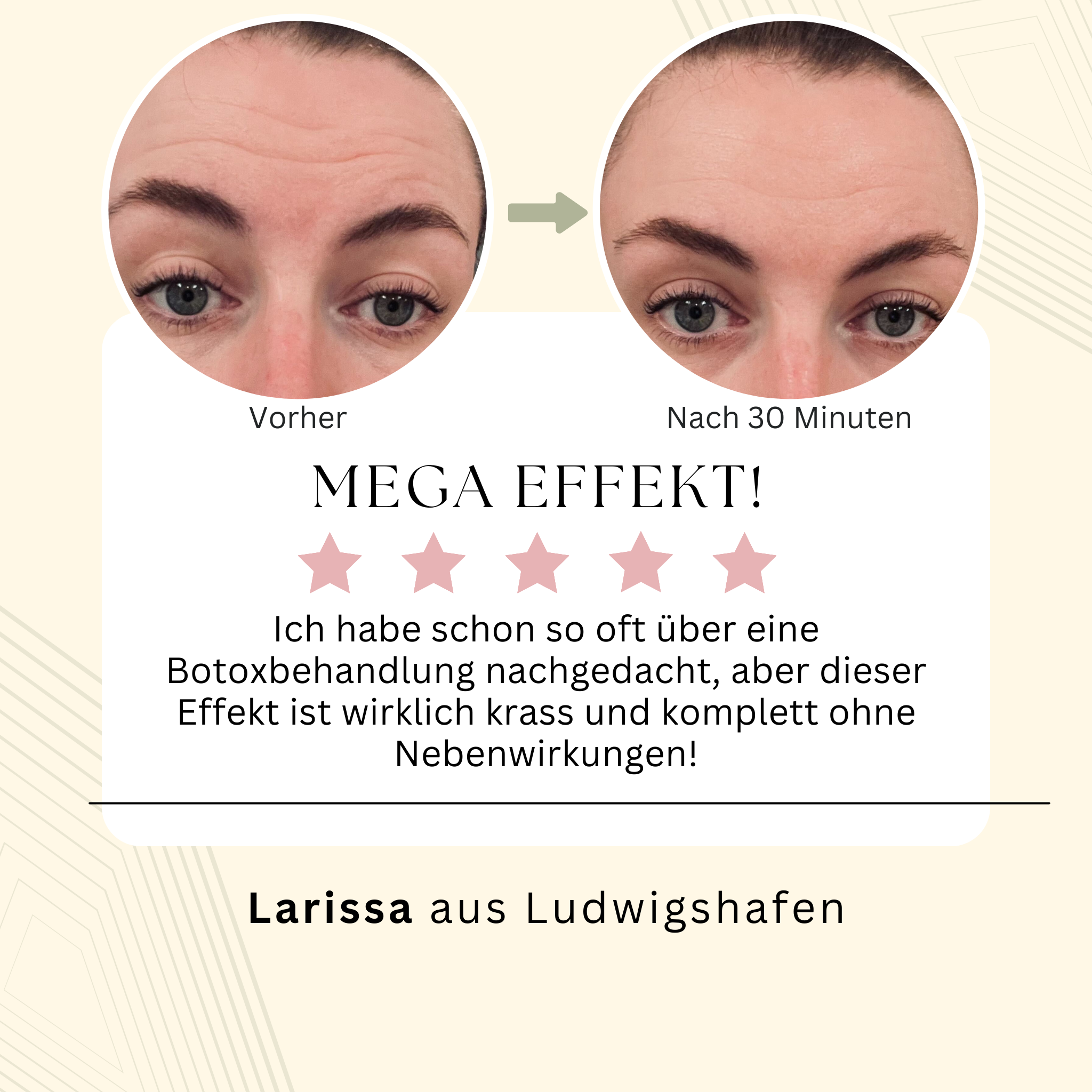 Botoxeffekt ohne Spritze oder Nebenwirkungen in 30 Minuten